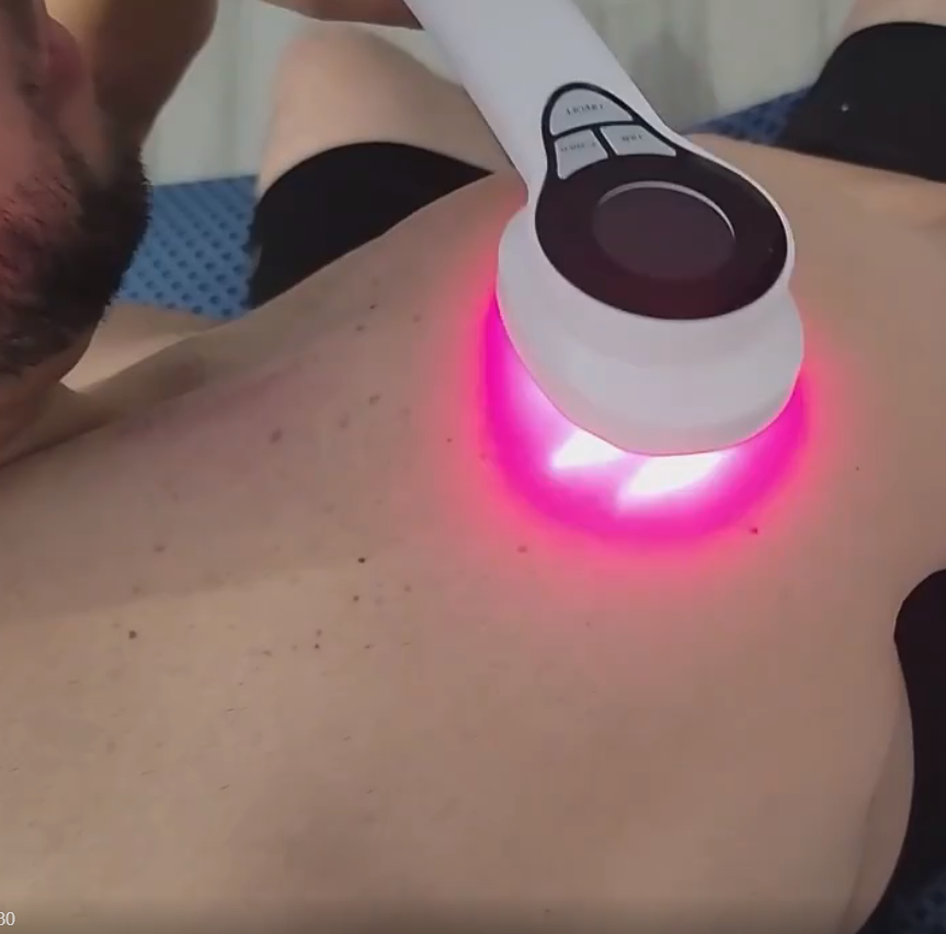 China 808nm laser